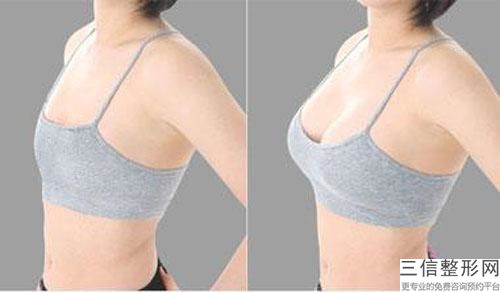 中國男人乳頭縮小醫(yī)院推薦：男人乳頭縮小醫(yī)院前50綜合大評選