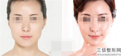中國鼻孔修復手術醫院推薦：鼻孔修復手術醫院top50詳情分析