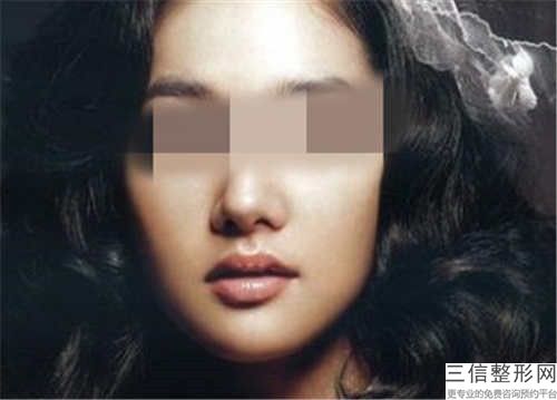 陰唇肥厚手術整形手術不適合那些人群