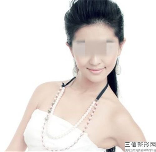 自體脂肪豐下巴手術(shù)哪種安全