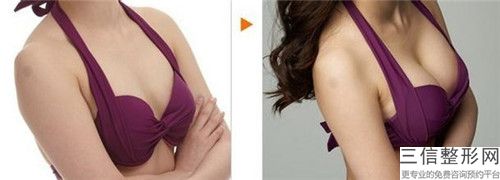 佳木斯市乳房微創(chuàng)手術(shù)手術(shù)哪位醫(yī)生好(董靜院長(zhǎng)醫(yī)生綜合實(shí)力靠前)