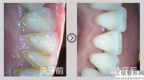 ?？谳喞潭〞粫Φ窖例l