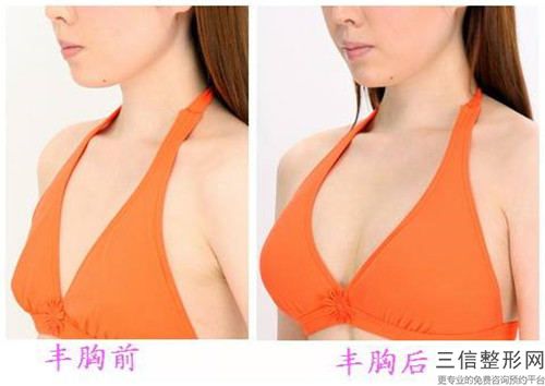 濰坊市乳房縮小整形醫院排行十強誰實力強（濰坊昌邑林連生美容外科診所口碑人氣匯總）