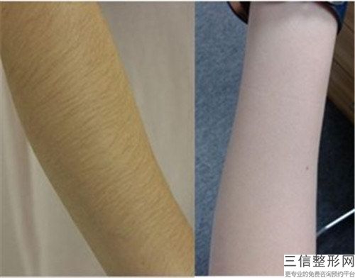 唐山市李春滿整形醫生價位表隆重發布
