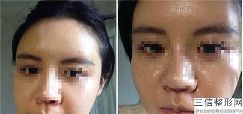 長春市整形醫院正規修復唇腭裂價格(長春馬麗醫療美容醫院誰與爭鋒)