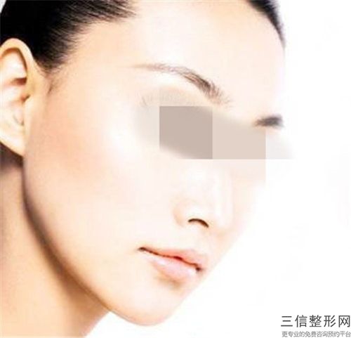 朱偉醫生中不中｜縮雙下巴｜附沈陽醫學院奉天醫院價目表