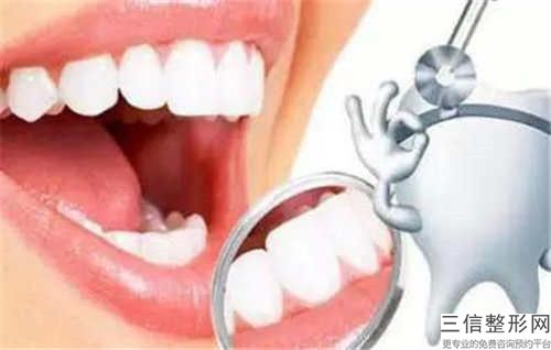 渭南全烤瓷牙術常用的材料有哪些，哪種效果好