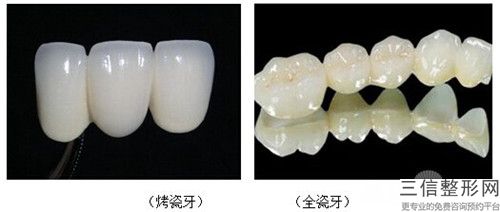 門牙斜斜矯正的副作用都哪些