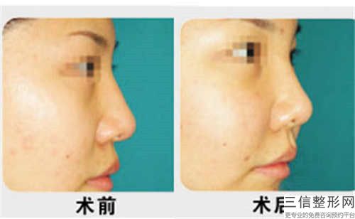 江門市兔唇手術治療哪個醫院好(江門市艾斯薇爾美容美體中心口碑好)