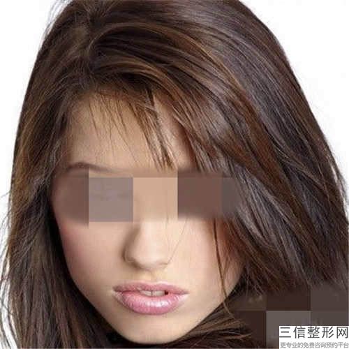 南陽唇裂畸形整型后如何做好術(shù)后護理工作