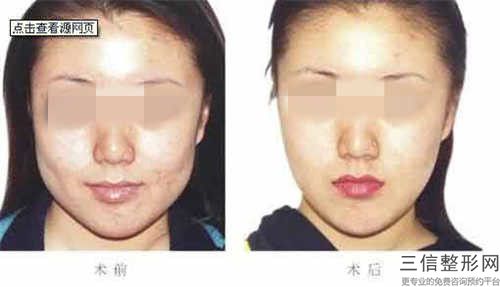 秦淮區專業牙齒咬合反頜牙科醫院有那些-南京斯唯爾口腔門診部大咖實力入圍