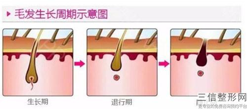 移植毛發結束后頭發生長效果_植發治療后術后效果好不好