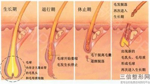 毛發移植治療手術的價錢會不會上幾萬元呢