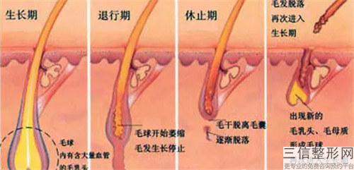 激光脫毛術收費是多少錢一場？有風險嗎？